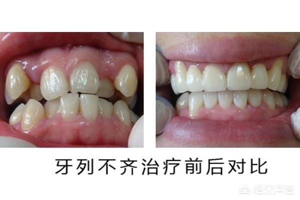 象山最新24小时牙医在线咨询方法分析(最方便真实的象山有没有24小时牙医方法)